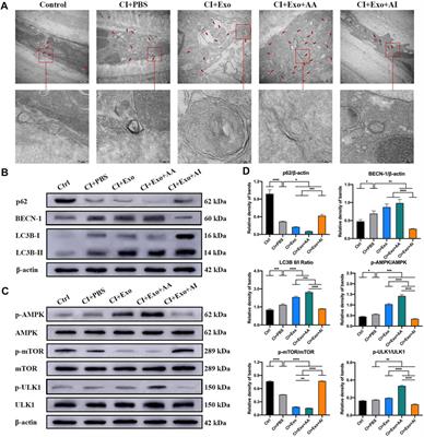 Exosomes From Human Umbilical Cord Mesenchymal Stem Cells Treat Corneal Injury via Autophagy Activation